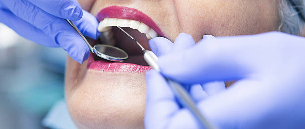 Best Emergency Wisdom Teeth Removal in Seminole, TX