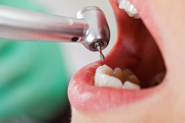 Best Emergency Treatment for Dental Infections or Abscesses in Seminole, TX
